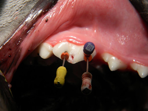 Intra-op root canal therapy on an upper 4th premolar with a slab fracture and pulp exposure.