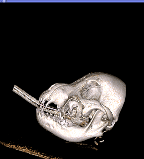CT image of Ruby's cyst